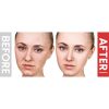 Masajeador facial de Microcorriente con Luz Roja y Recargable