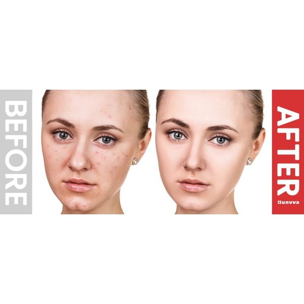 Masajeador facial de Microcorriente con Luz Roja y Recargable
